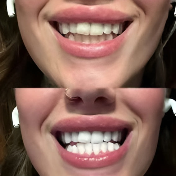 MijnSmile® NEW Purple Toothpaste