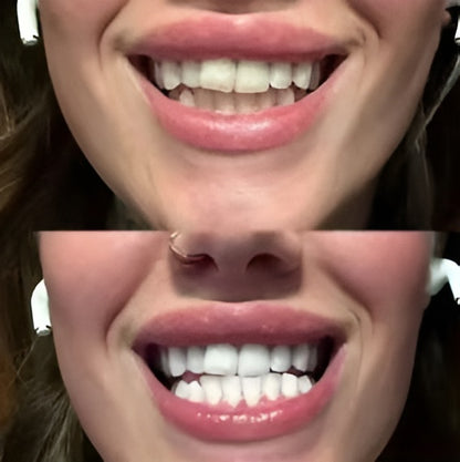 MijnSmile  V34 Foam Toothpaste